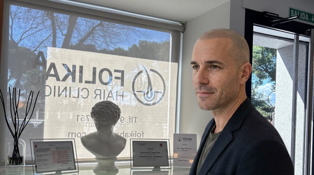 Hombre con resultado cicatrizado de micropigmentación capilar en Madrid mostrando un efecto de densidad natural en la clínica Folika Hair Clinic en Chamberí, Madrid.